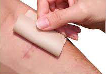 pedifix-scar.jpg